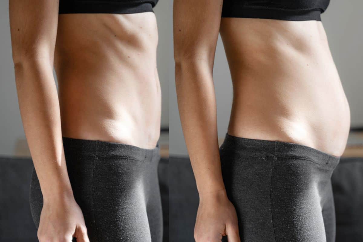 How long does diastasis recti take to improve Chessington?