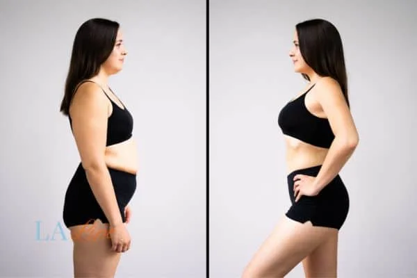 link between body image and mental health Chessington