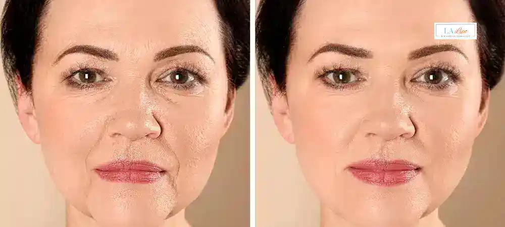Why Aren’t My Skincare Products Making My Sagging Skin Look Firmer Chessington?