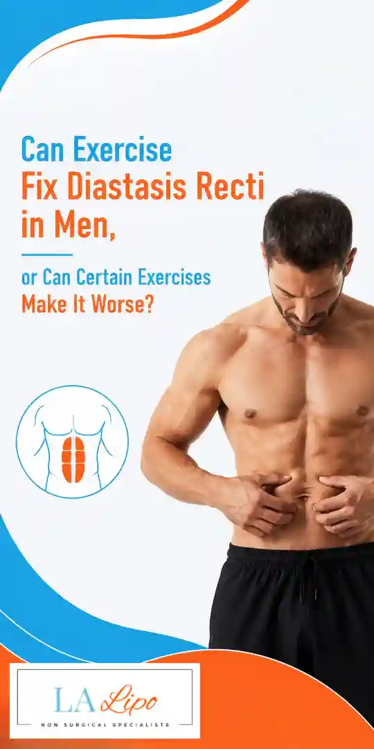 Can Exercise Fix Diastasis Recti in Men, or Can Certain Exercises Make It Worse Chessington?